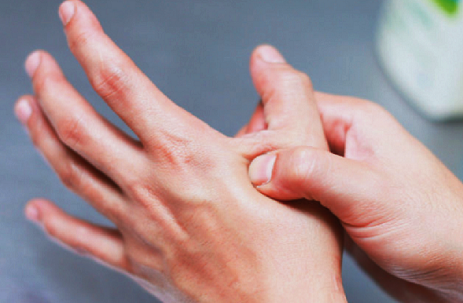 Ways of managing thumb sprain