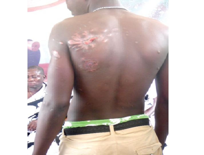 Mr Stephen Awulley, one of the victims of land guard attacks, showing the injury he sustained during one of such attacks on his family members.