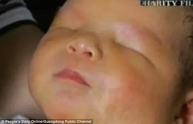The child was born on September 20 with a rare condition meaning he has no eyes