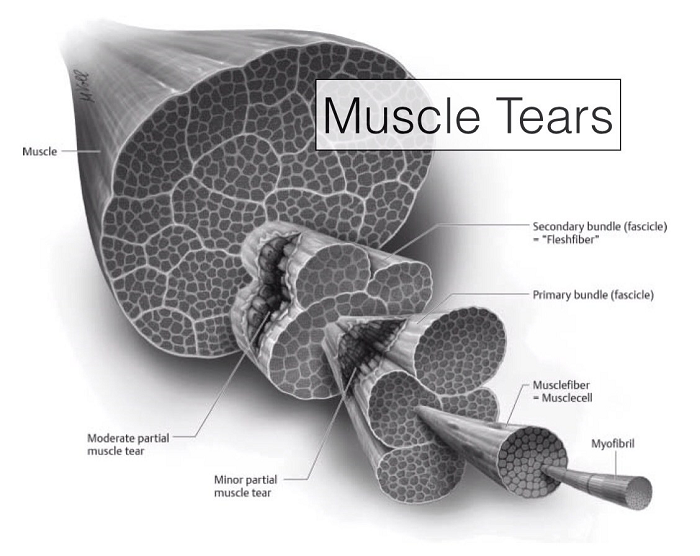 Why shoulder muscle tear?