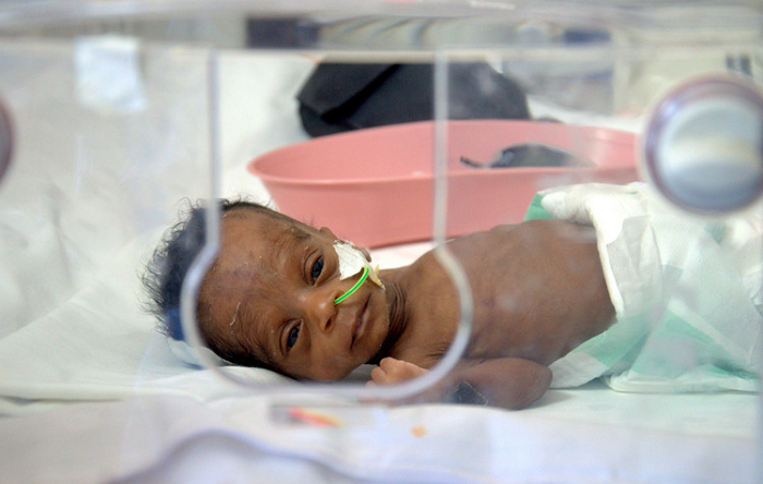 Preterm babies are threat to Ghana's healthcare sector—RISE-Ghana