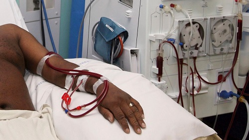 NHIA to roll out dialysis support program on June 1