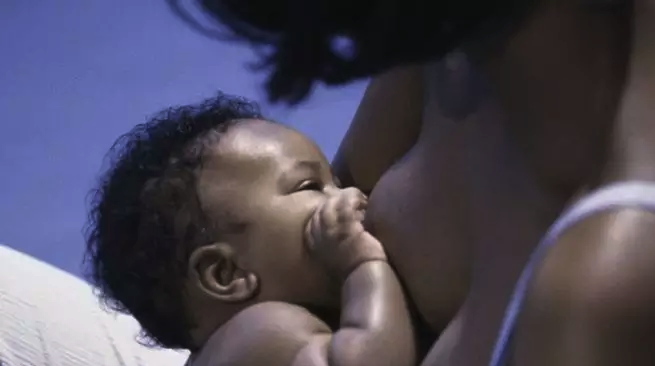 Formula-fed babies have worse jaw alignment and are more likely to need orthodontic work as they get older. This is probably because the sucking action during breastfeeding improves the development of facial muscles and the shape of the palate.
