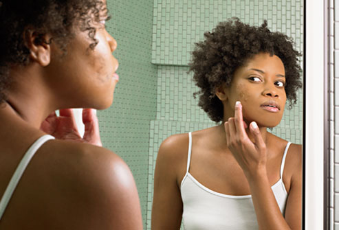 6 Ways love making causes acne and what to do about it