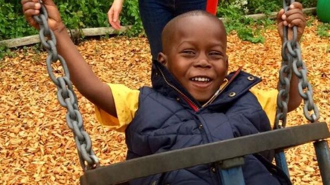 Ethan Suglo is to have an operation at the John Radcliffe Hospital later