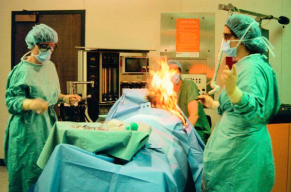 Woman’s fart sparks fire during surgery