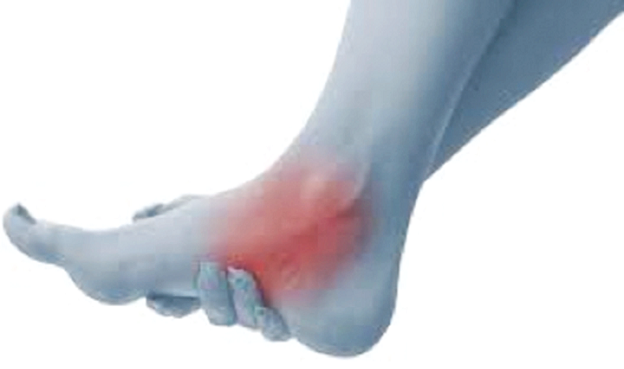 You may feel numbness, tingling sensation and pain in the foot and ankle. 