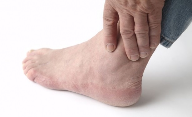 Will this painful  ankle ever go away? (pt2)