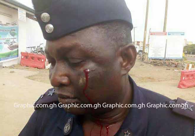 Two people, including the Operations Commander of the Tema Regional Police Command were injured on Thursday when workers on the Tema Port Expansion project embarked on a sit down strike.