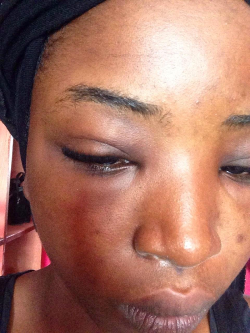 Man  assaults  teacher trainee (Library photo)