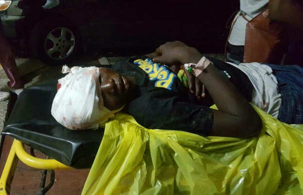 17-year-old boy shot at Salafest on admission at KATH