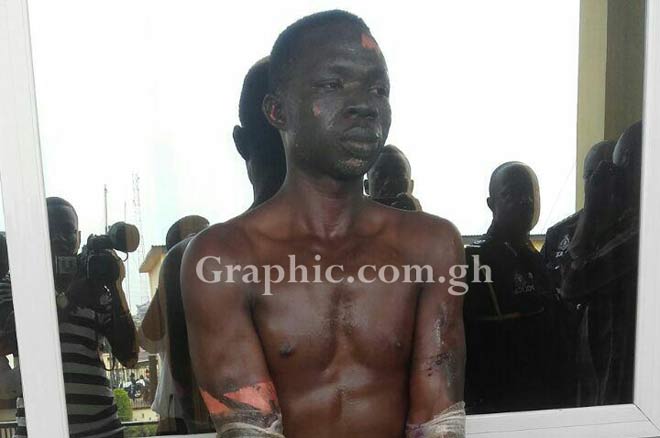 Godfred Yamma, the Jealous lover who burnt ex-girlfriend, three others arrested