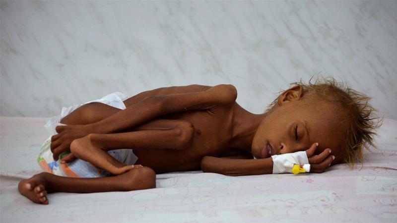 Starving Yemenis resort to eating rubbish
