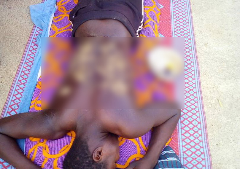 One of the victims with severe back wounds resulting from lashes