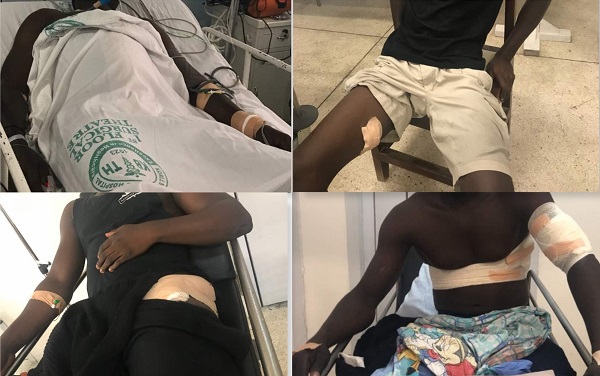 4 Policemen shot; attacked when responding to distress call