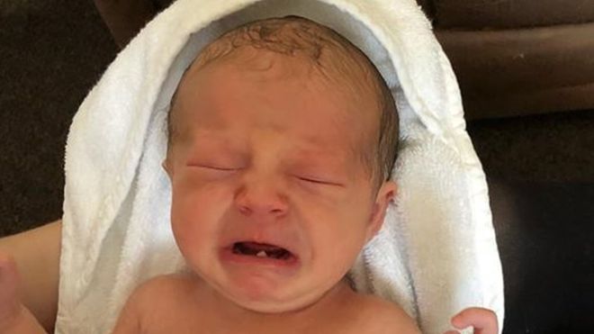 Isla-Rose's mum, Jasmin says she "never expected" to take her baby to the dentist so young. The tooth was removed successfully and put in a box for the family to take home
