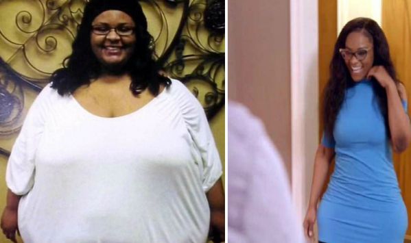 Woman who Lost 200 lbs Is unrecognizable after having mounds of saggy skin removed
