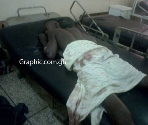 Adama Nachema who received several bullets in the buttocks is recovering at the Kintampo Hospital