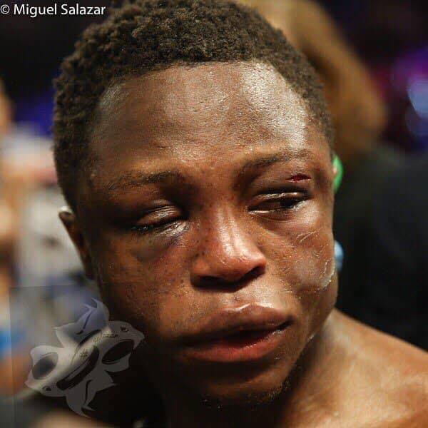 Isaac Dogboe who had a badly swollen face after the bout said he will now take a break, regroup and aim to come back to the top again.