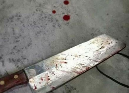 Woman cuts off cheating husband's penis and throws it out window