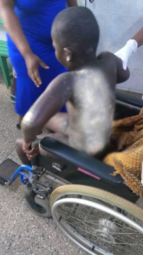 Akwatia: Mother pours hot water on daughter