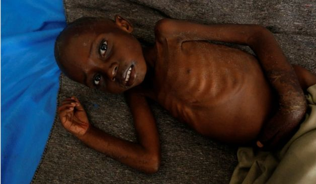 DR Congo's crisis: 400,000 children face starvation