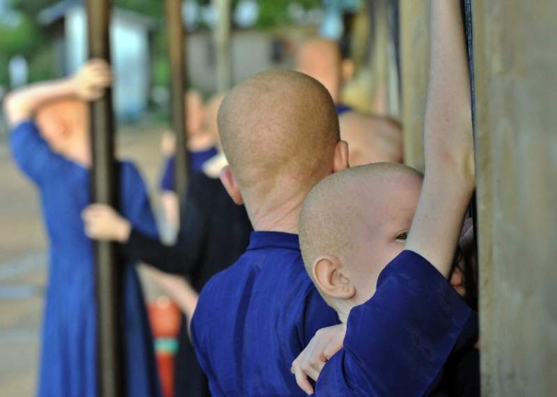 Albino children in parts of Africa are targeted by groups who believe their body parts bring luck (stock image)