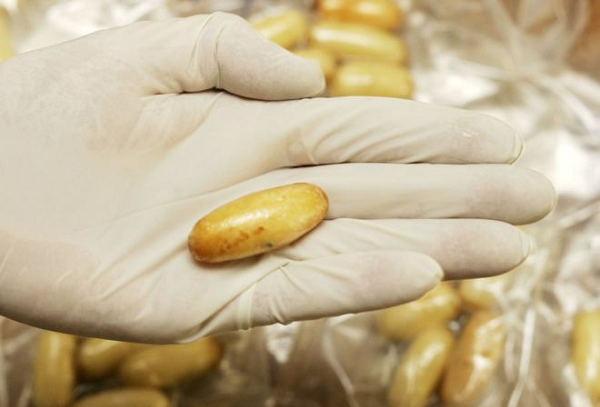 India police extract 106 cocaine capsules from woman's stomach