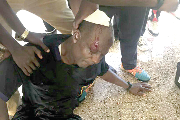 Referee Nuhu Liman was badly injured when he was hit by an object during the Elmina Sharks-Medeama game at the Nduom Stadium.
