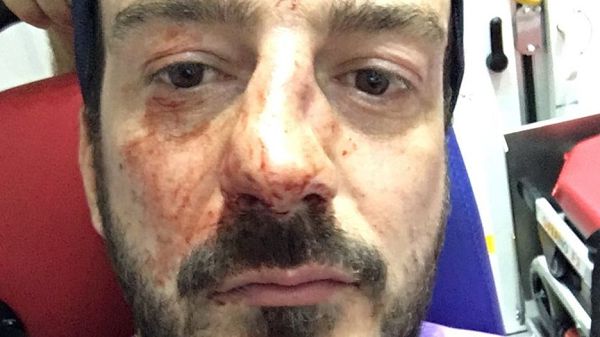 Mr Mélanie shared a photo of his injuries from the assault 