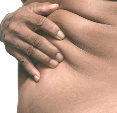 Do not allow the folds on your belly and sides to multiply in ripples.