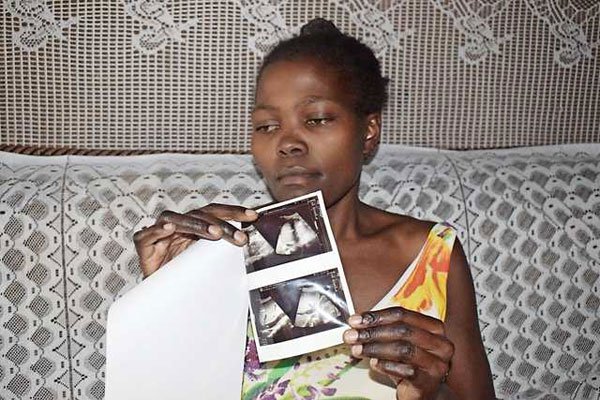 Irene Joyce Oluoch displays CT scan images showing traces of cotton wool in her womb. They were left behind by doctors who performed a caesarean procedure on her at Jaramogi Odinga Oginga Teaching and Referral Hospital seven months ago.