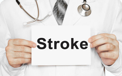 Dealing with the stroke scare  