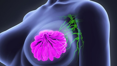 Surviving breast cancer: A survivor’s experience