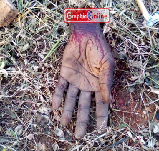 Police hunt for man who chopped off lunatic’s hand