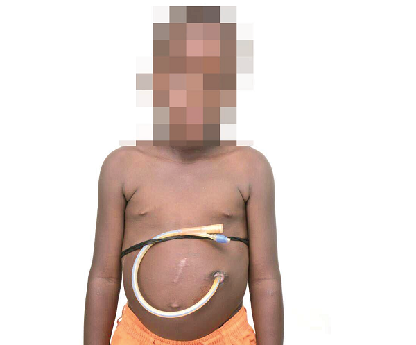 One of the children paraded in public by the self-styled philanthropists
