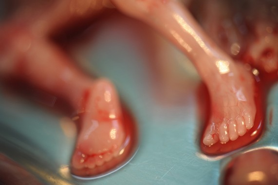 Nigerian women committed 2.7m abortions in 2017 – Study