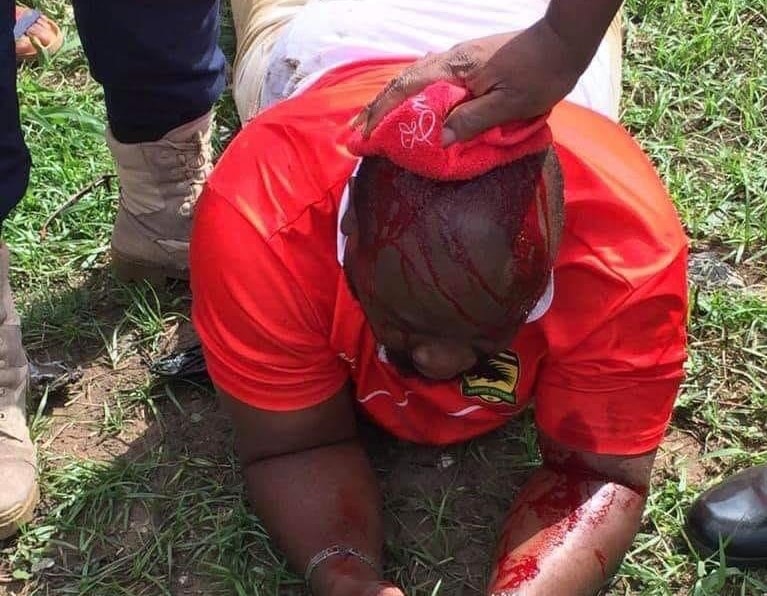Shooting incident mars Chelsea,  Kotoko game at Berekum