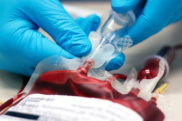  Blood transfusion is a necessary medical intervention that saves lives or improves the quality of life of millions of patients