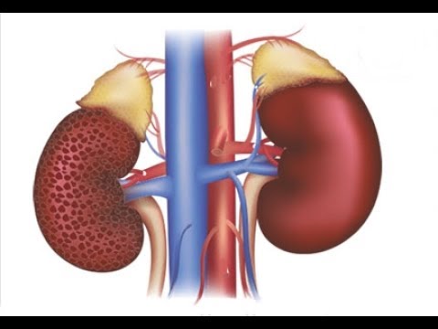 Why most causes of kidney disease in Ghana are unknown