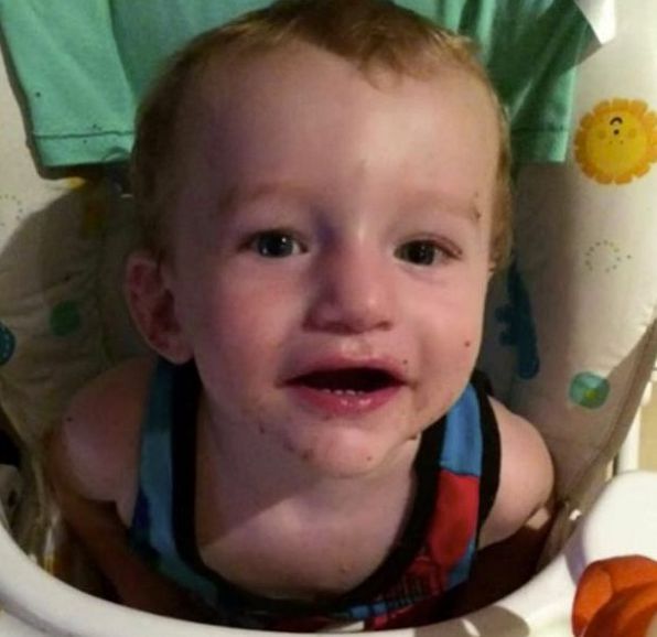 Corby, who lived in Australia, was found to have 81 separate injuries