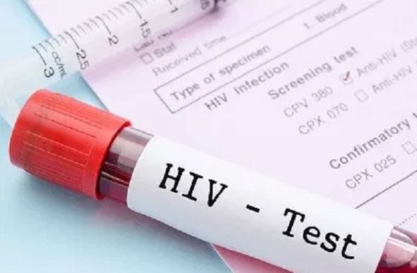 46,000 People living with HIV refuse treatment