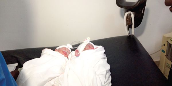 The newly delivered twins