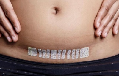 Argentina: 11-yr-old rape victim undergoes caesarean section