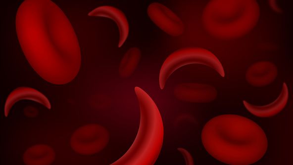 Pain, trauma of sickle cell patients must end