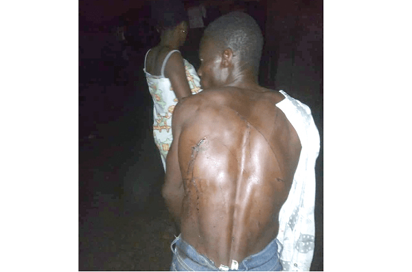 One of the people who were subjected to beating by the attackers