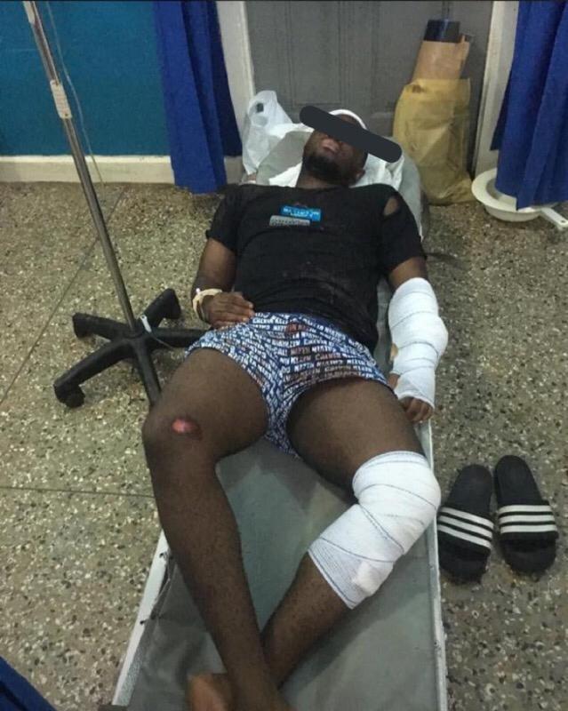 Armed robbers attack University of Ghana student on campus