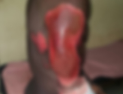 The victim after the incident