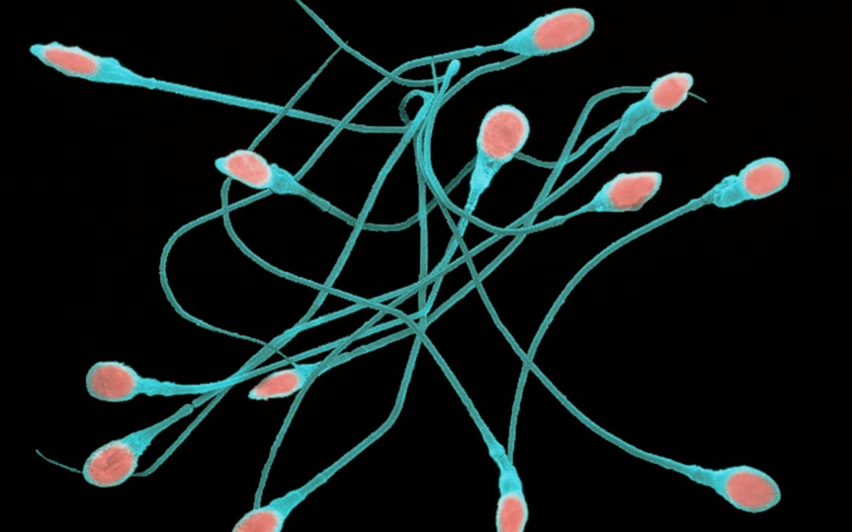 World's first HIV positive sperm bank launched in effort to reduce stigma