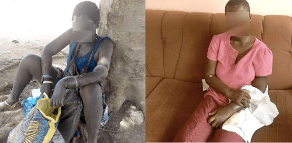 Left: Araba on the day she was picked from the street. RIGHT: Her days in the hospital